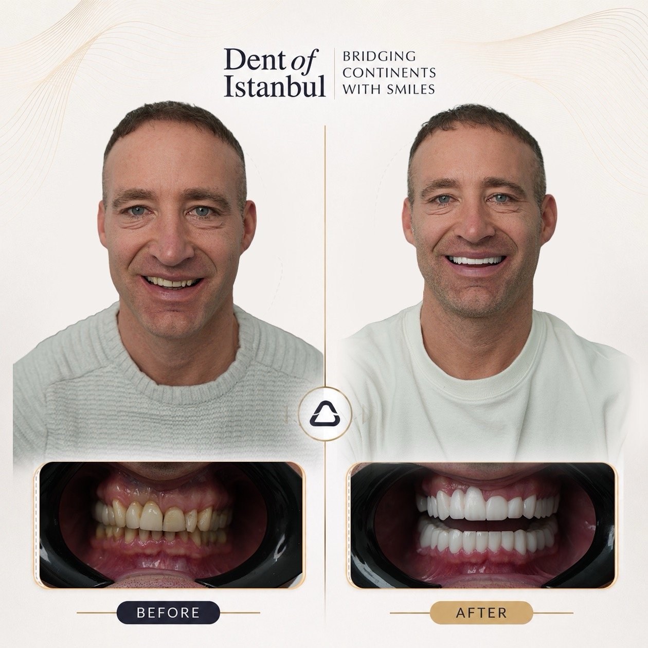 Ryan Before and After